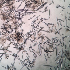 Mikroigły (spikule) z gąbki słodkowodnej